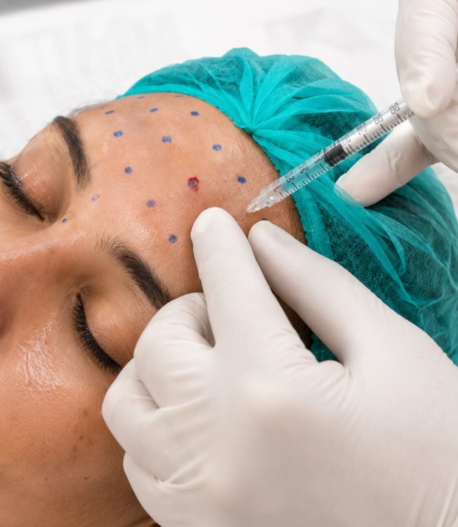Botox IMG 1