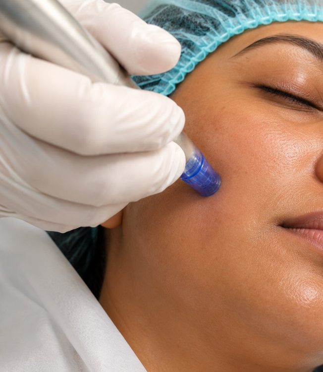 Dermawhite with Microderm IMG 2