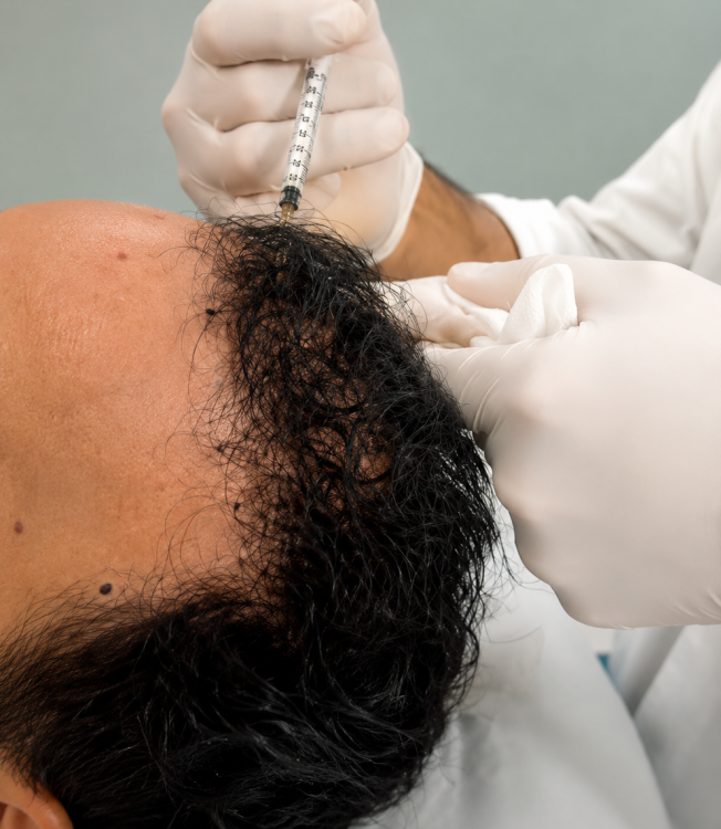 Hair Filler-3