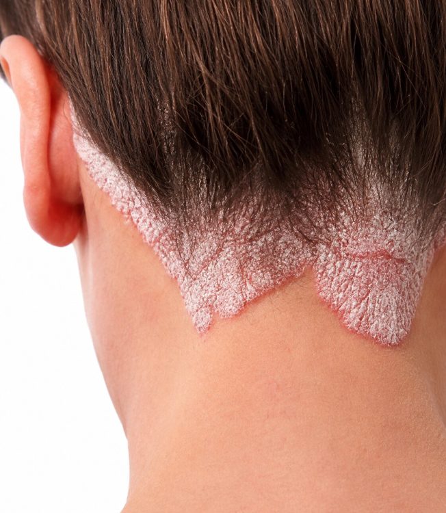 Skin Diseases3